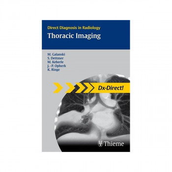 Thoracic Imaging 