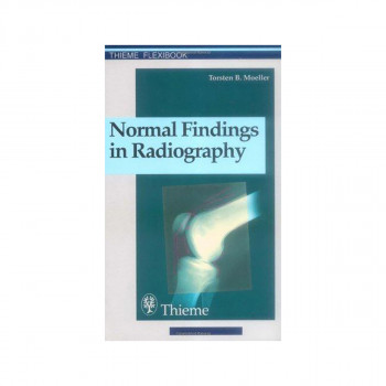 Normal Findings in Radiography : . Zus.-Arb.: Torsten B. Moeller Translated by T 