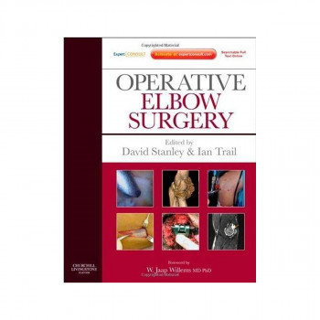 Operative Elbow Surgery : Expert Consult: Online and Print 