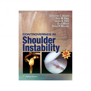 Controversies in Shoulder Instability 