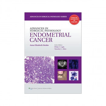 Advances in Surgical Pathology. Endometrial Cancer - Advances in Surgical Pathol 