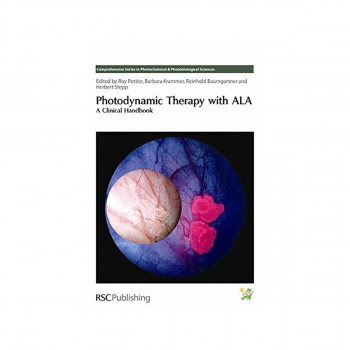 Photodynamic Therapy with ALA : A Clinical Handbook 