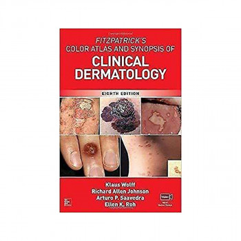 FITZPATRICK'S COLOR ATLAS N SYNOPSIS OF CLINICAL DERMATOLOGY 