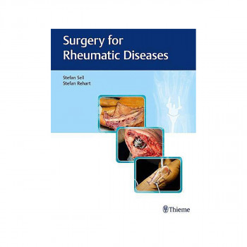 Surgery for Rheumatic Diseases 