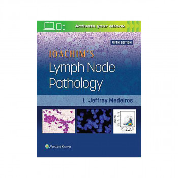 Ioachim's Lymph Node Pathology 