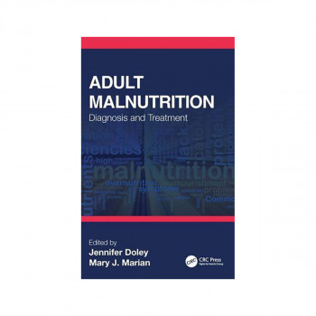 Adult Malnutrition: Diagnosis and Treatment 