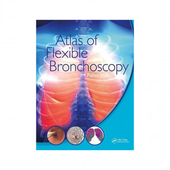 Atlas of Flexible Bronchoscopy 