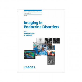 Imaging in Endocrine Disorders - Frontiers of Hormone Research 