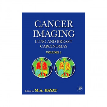 Cancer Imaging 