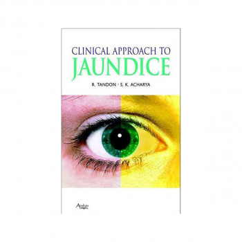 Clinical Approach to Jaundice 