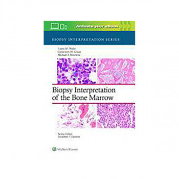 Biopsy Interpretation of the Bone Marrow 