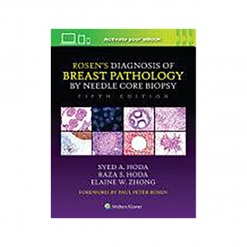 Rosen's Diagnosis of Breast Pathology by Needle Core Biopsy 