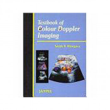 Textbook of Colour Doppler Imaging 