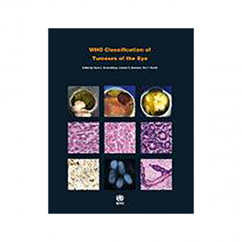 WHO Classification of Tumours of the Eye 