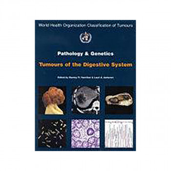 Pathology and Genetics of Tumours of the Digestive System 