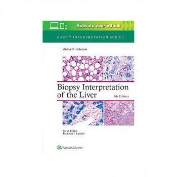 Biopsy Interpretation of the Liver 