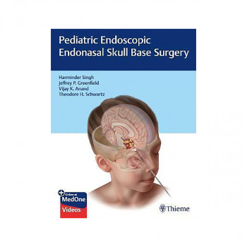 Pediatric Endoscopic Endonasal Skull Base Surgery 