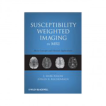 Susceptibility Weighted Imaging in MRI 