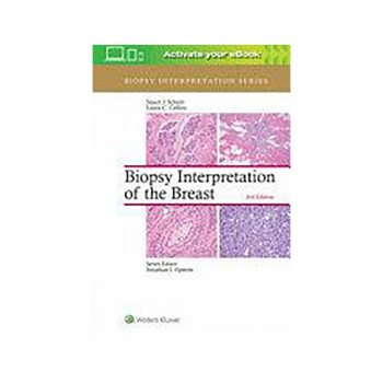 Biopsy Interpretation of the Breast 