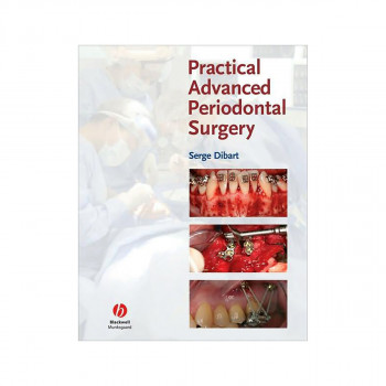Practical Advanced Periodontal Surgery 