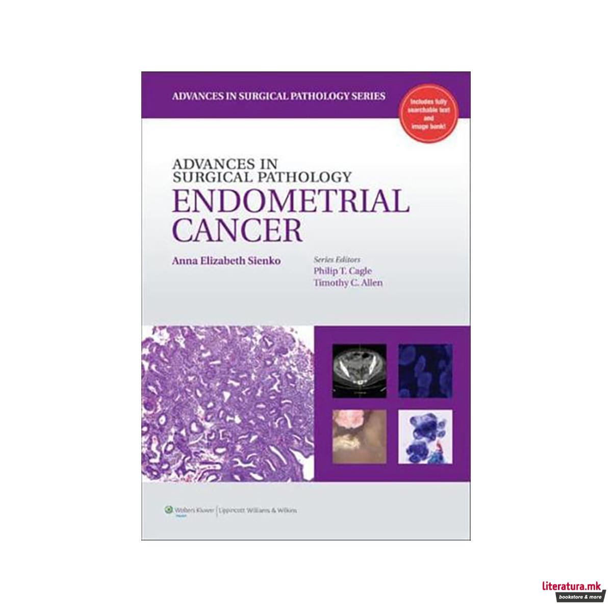 Advances in Surgical Pathology. Endometrial Cancer - Advances in Surgical Pathol 