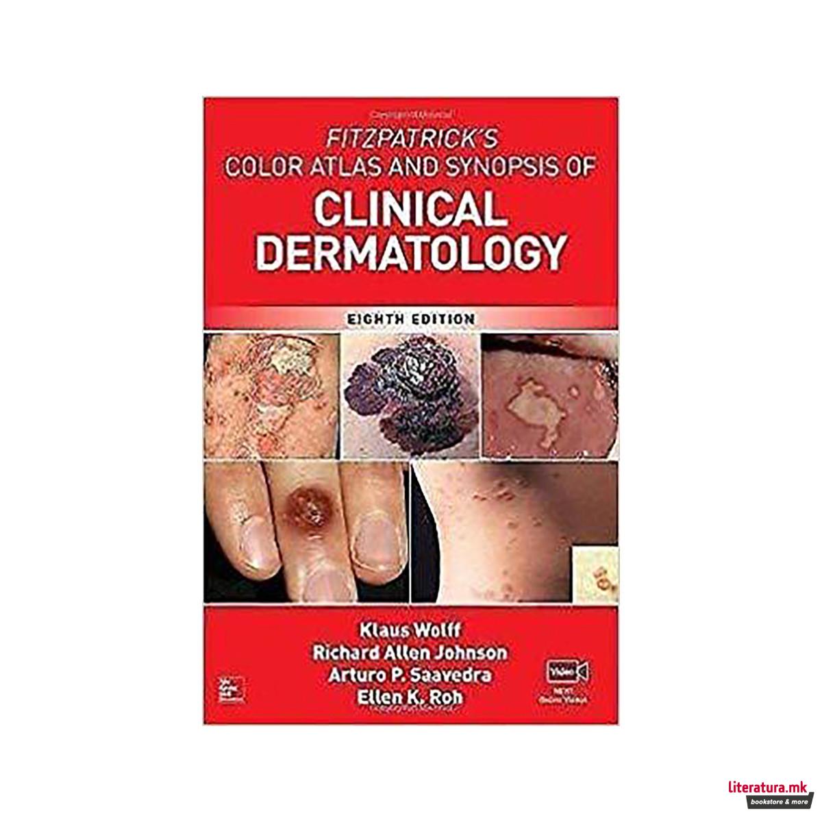 FITZPATRICK'S COLOR ATLAS N SYNOPSIS OF CLINICAL DERMATOLOGY