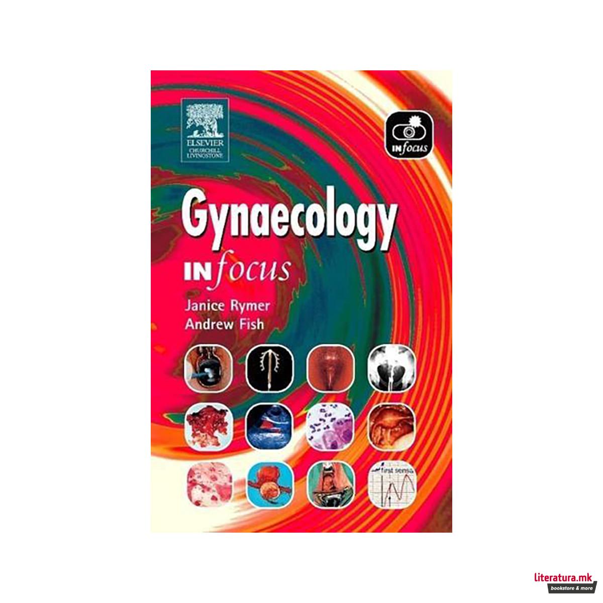 Gynaecology - In Focus 