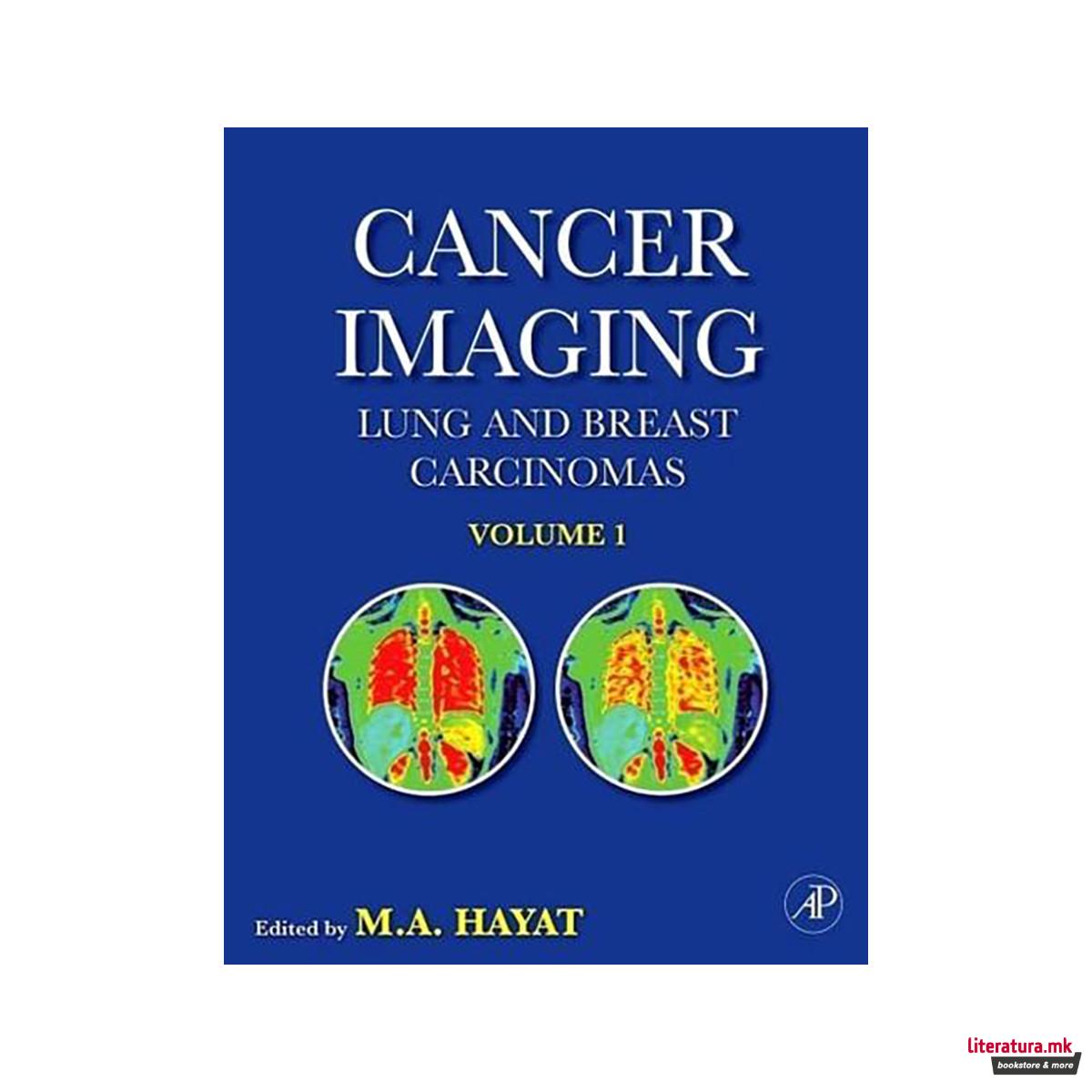 Cancer Imaging 