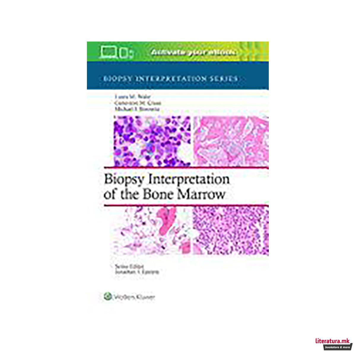 Biopsy Interpretation of the Bone Marrow 