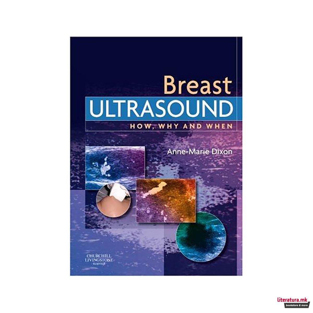 Breast Ultrasound: How, Why and When, 1e 