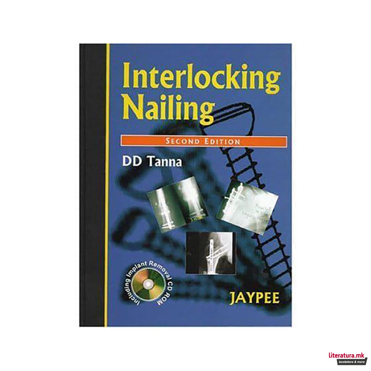 Interlocking Nailing 