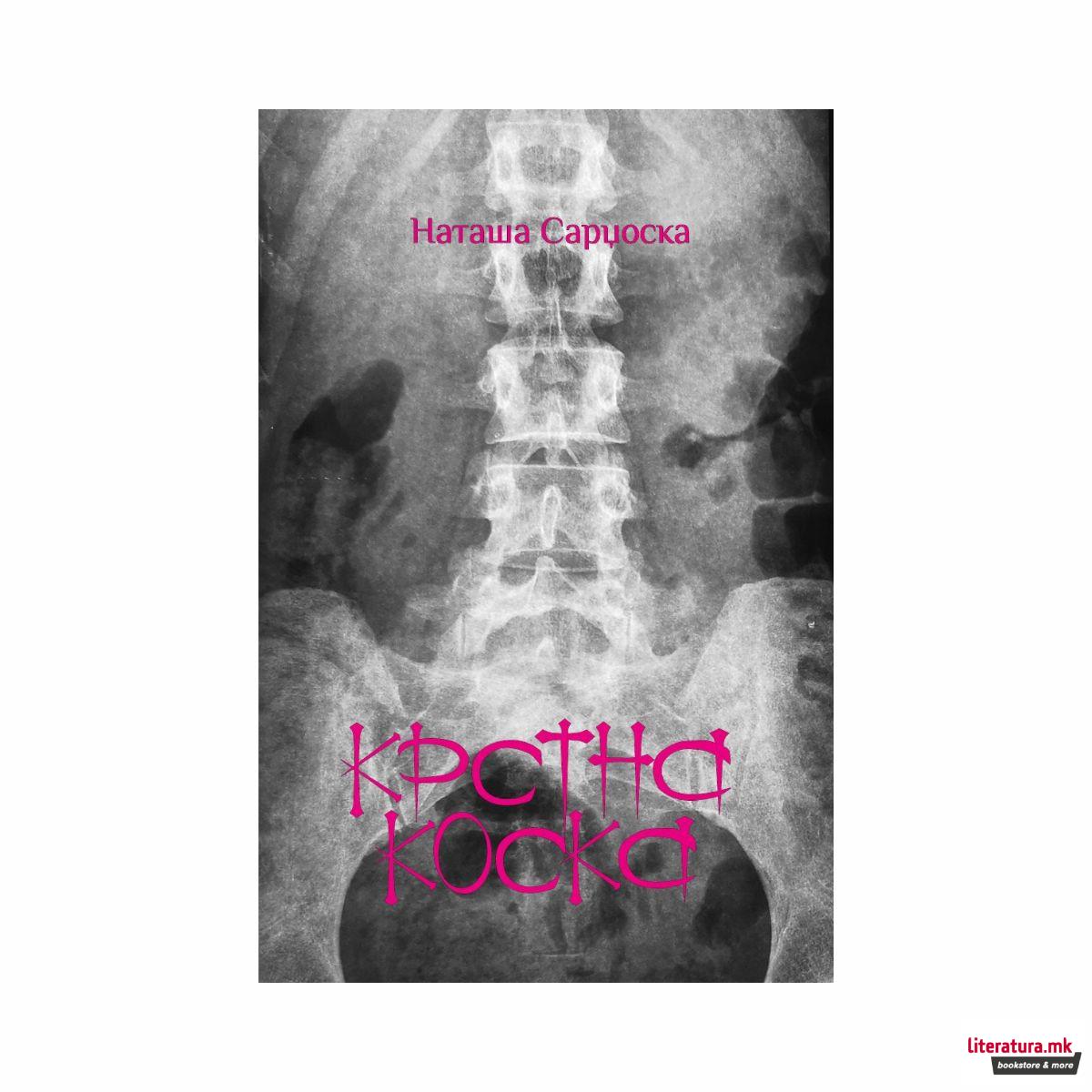 Крстна коска 