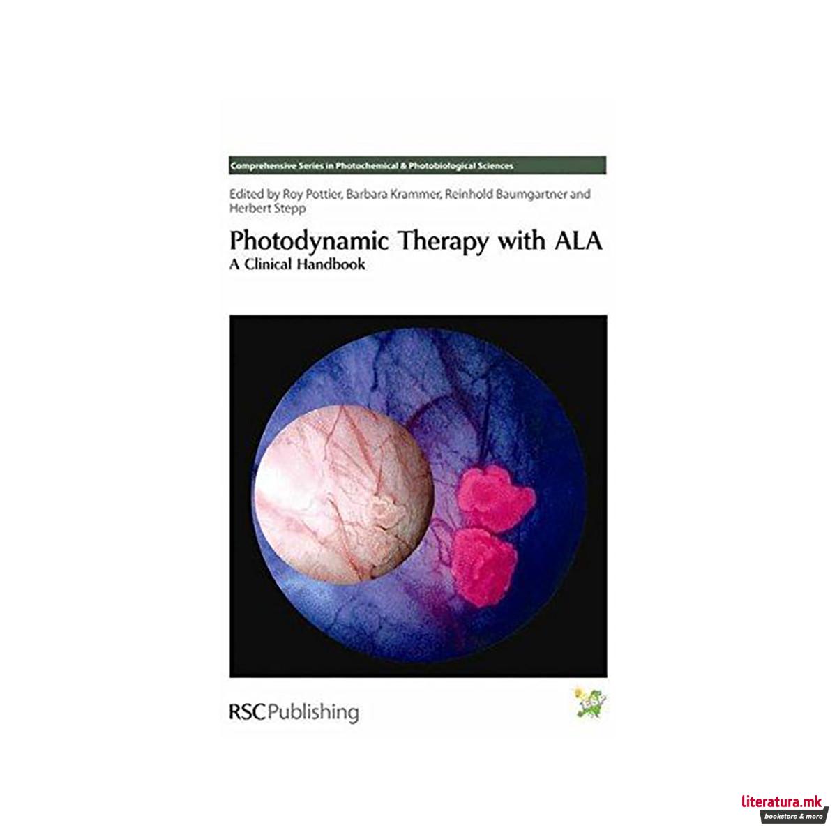 Photodynamic Therapy with ALA : A Clinical Handbook 