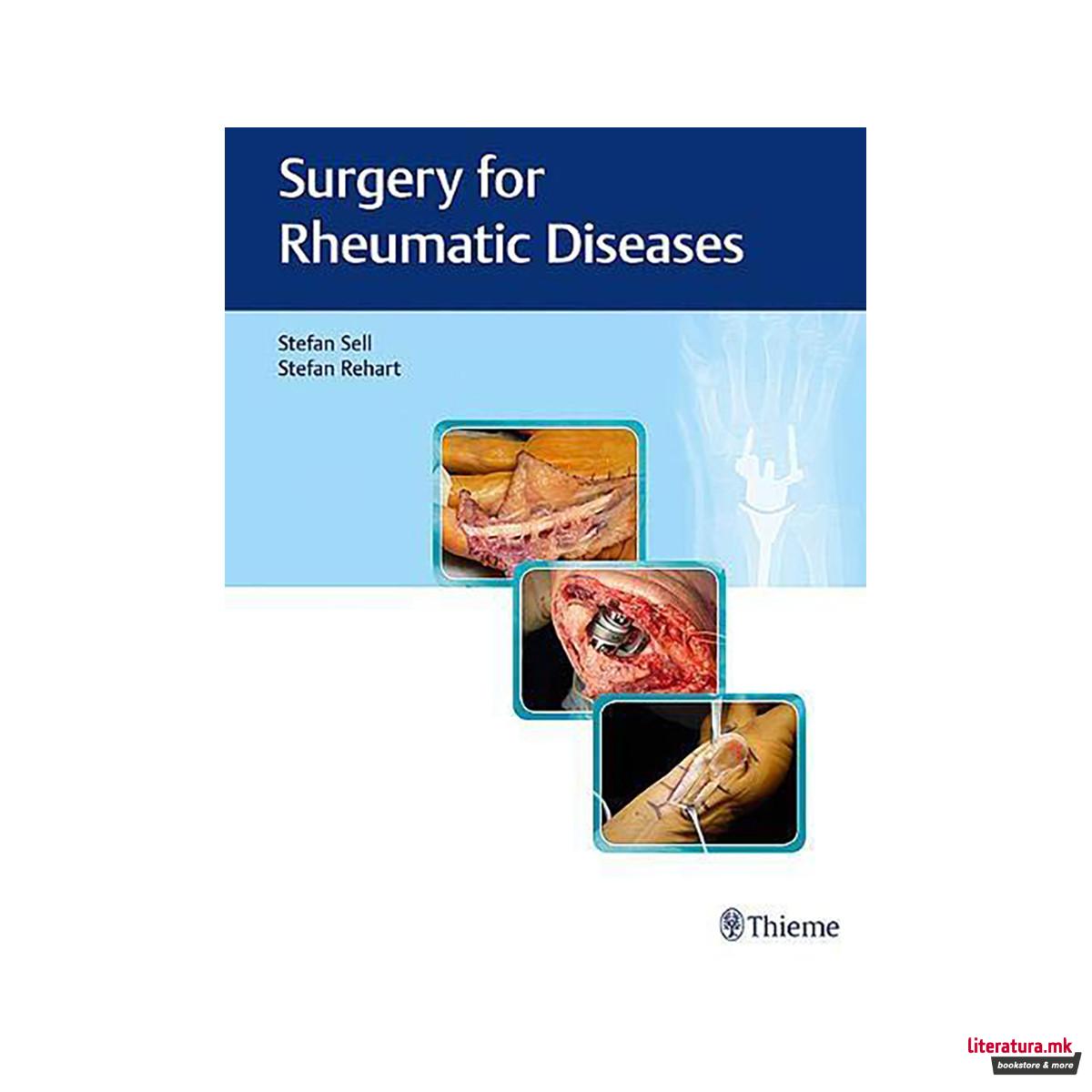 Surgery for Rheumatic Diseases 