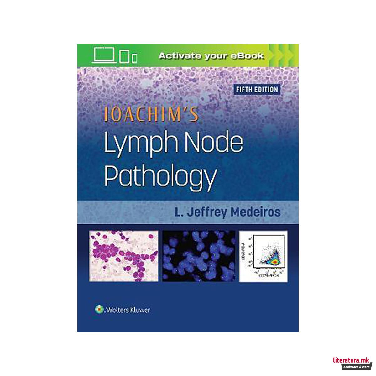 Ioachim's Lymph Node Pathology 