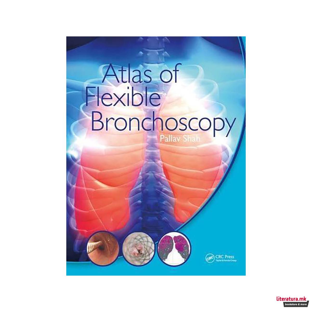 Atlas of Flexible Bronchoscopy 