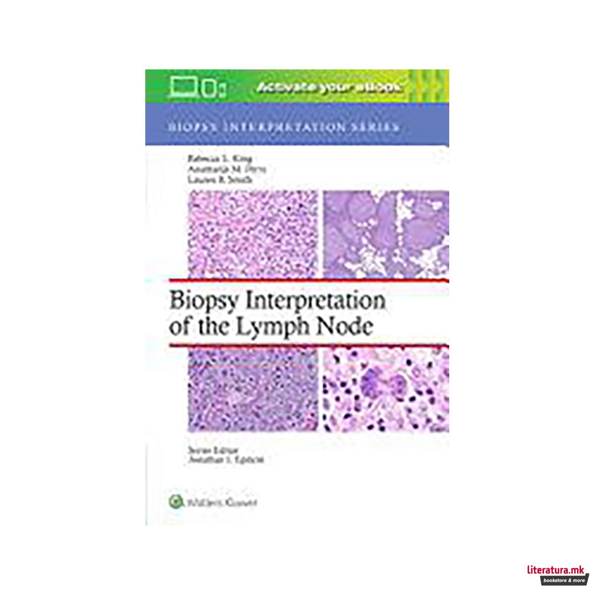 Biopsy Interpretation of the Lymph Node 