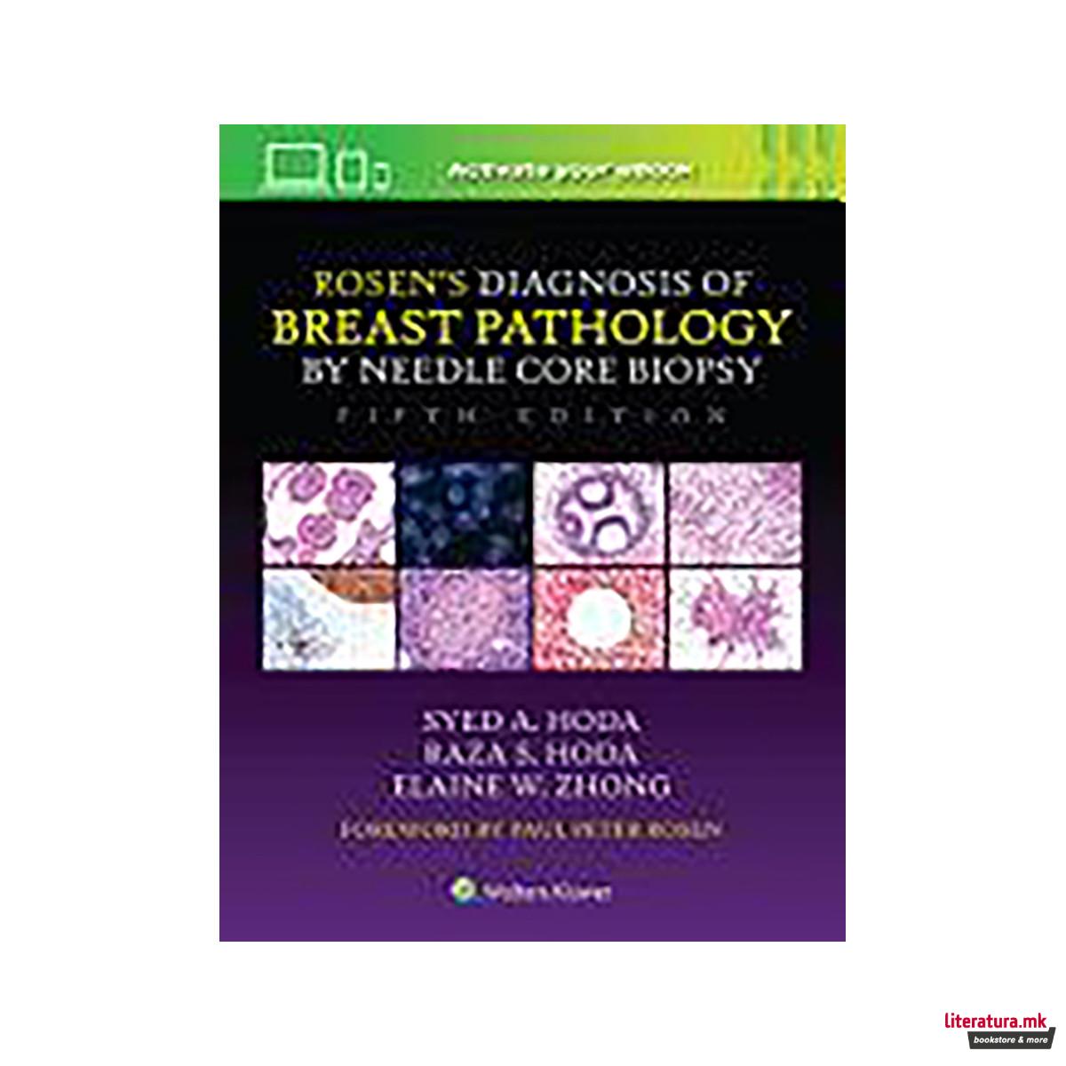 Rosen's Diagnosis of Breast Pathology by Needle Core Biopsy 