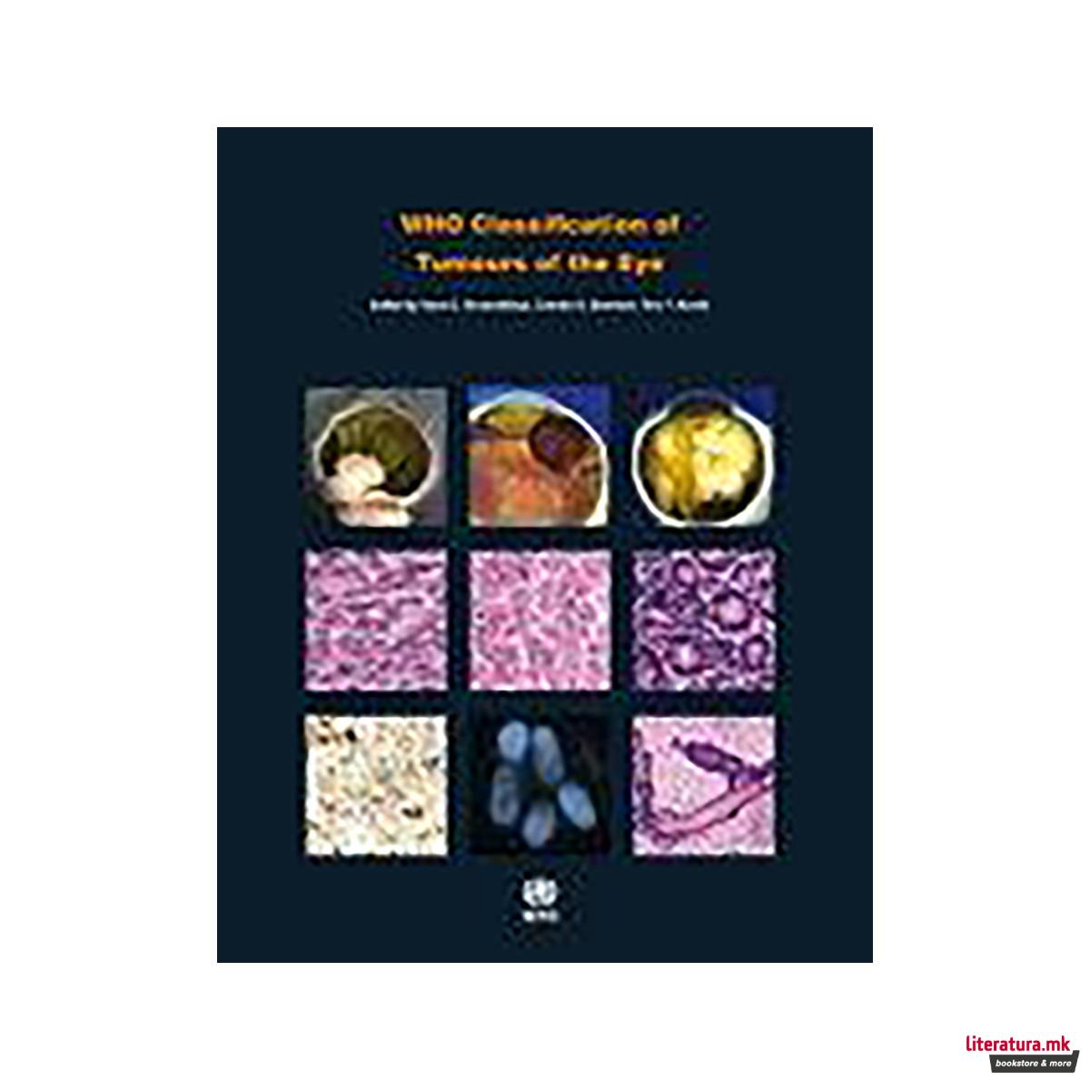 WHO Classification of Tumours of the Eye 