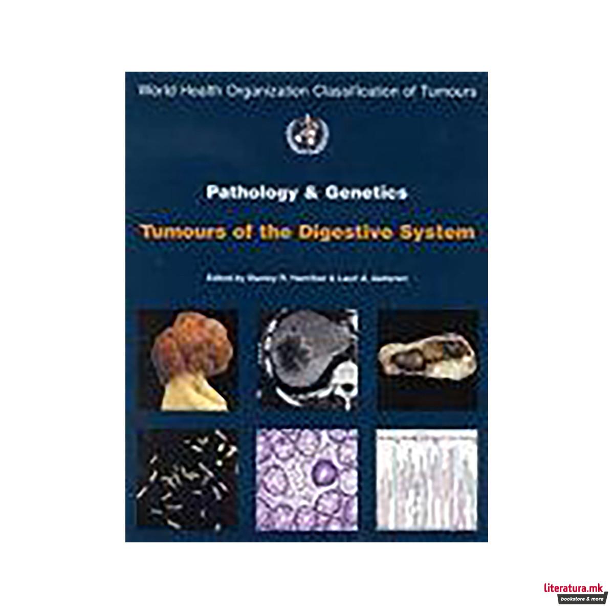 Pathology and Genetics of Tumours of the Digestive System 