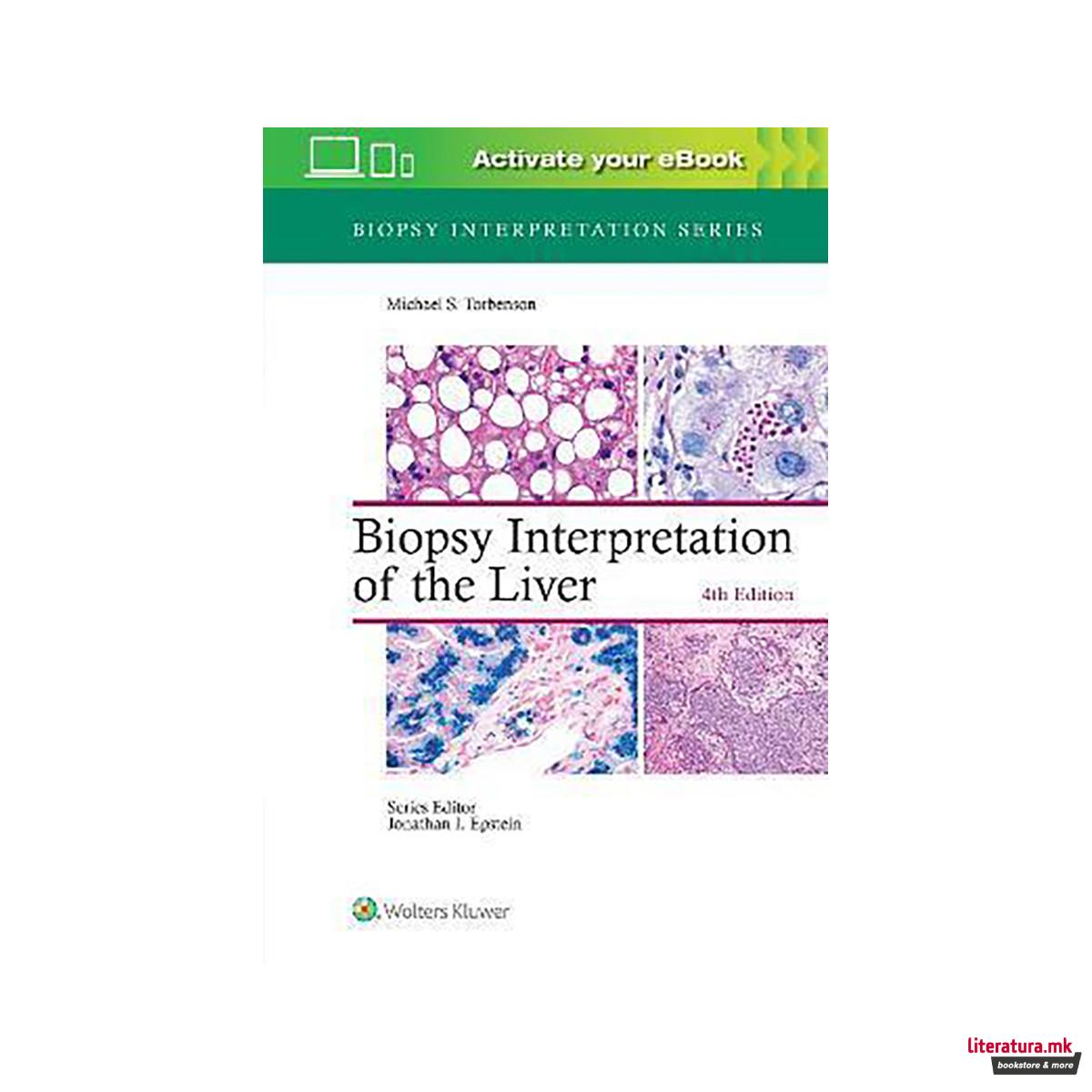 Biopsy Interpretation of the Liver 