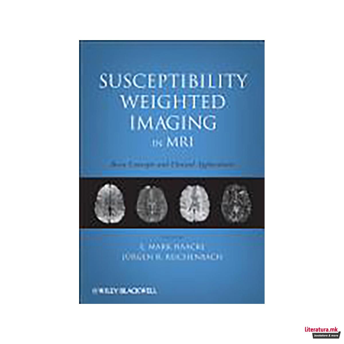 Susceptibility Weighted Imaging in MRI 