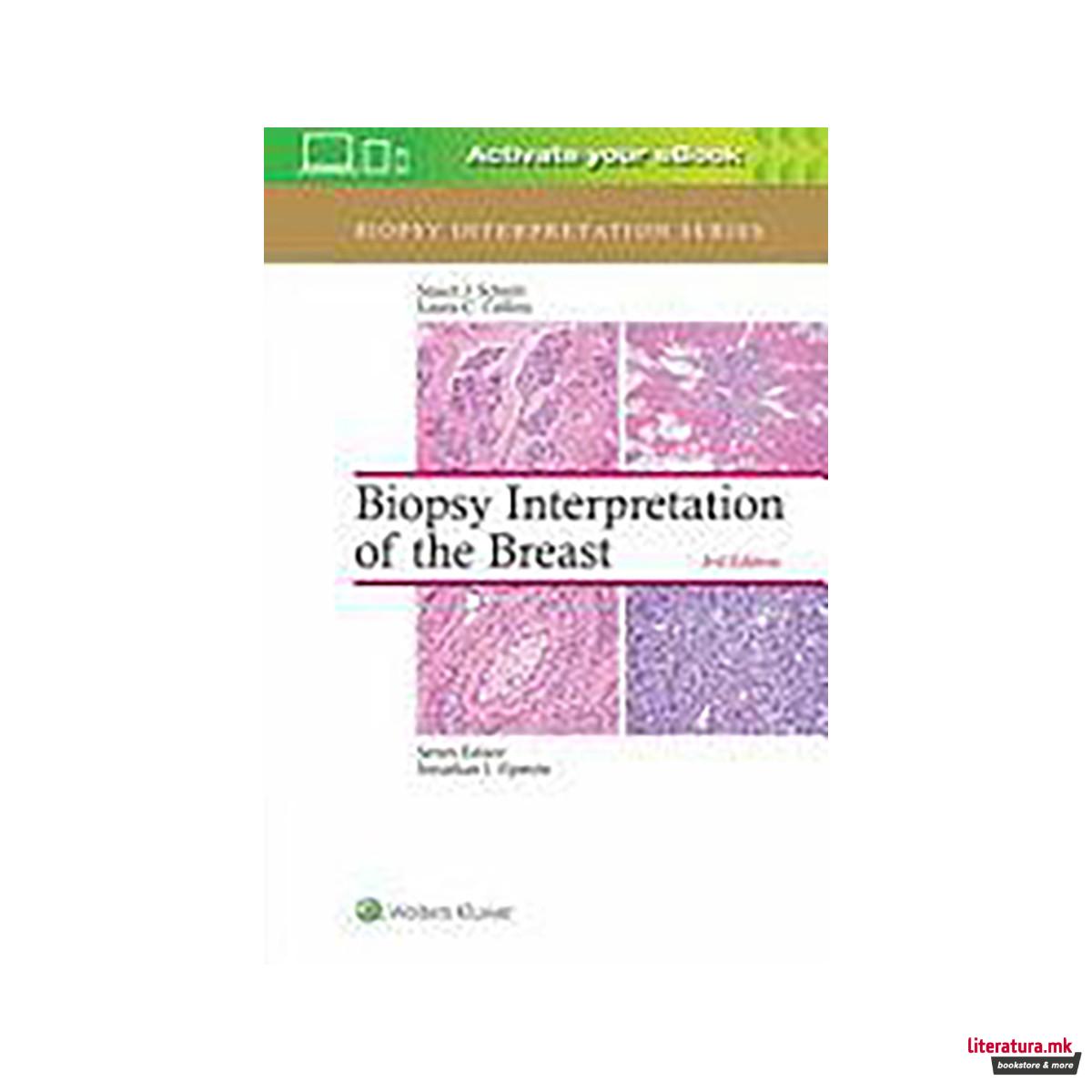 Biopsy Interpretation of the Breast 