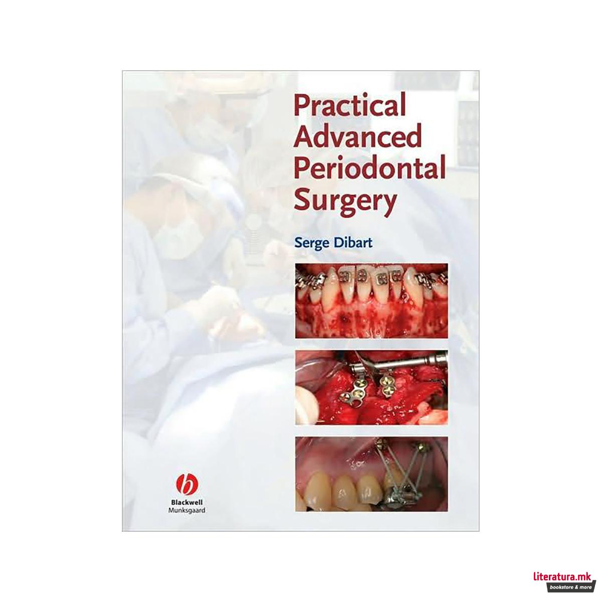 Practical Advanced Periodontal Surgery 
